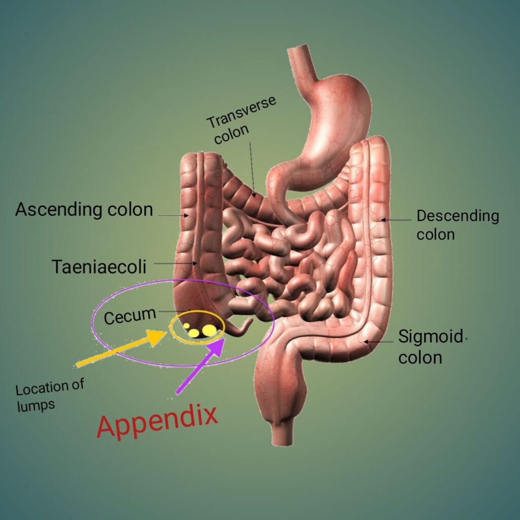 Lower Right Back Pain Causes Treatment Clarendon Chiropractic